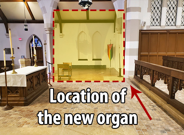 Diagram of location for new organ